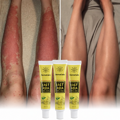 DermaCalm™ Herbal Cream  | Natural relief for skin prone to eczema and psoriasis