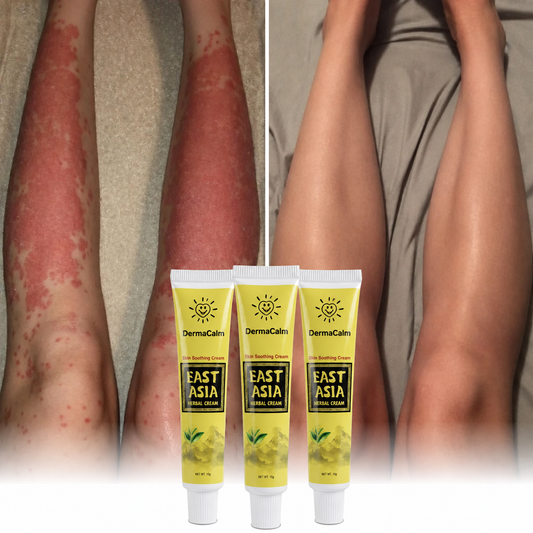 DermaCalm™ Herbal Cream  | Natural relief for skin prone to eczema and psoriasis
