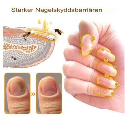 NailRepair™ | Fast-Acting, Long-Lasting Relief