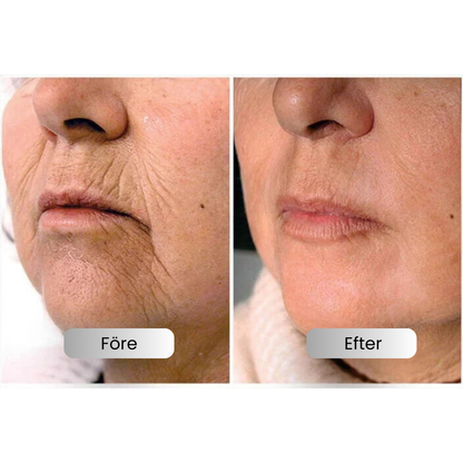 BotoxLift™ | Wrinkle Treatment Serum