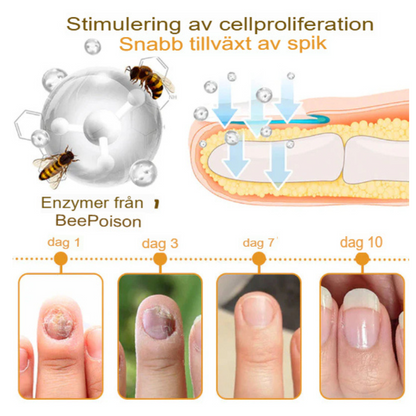 NailRepair™ | Fast-Acting, Long-Lasting Relief