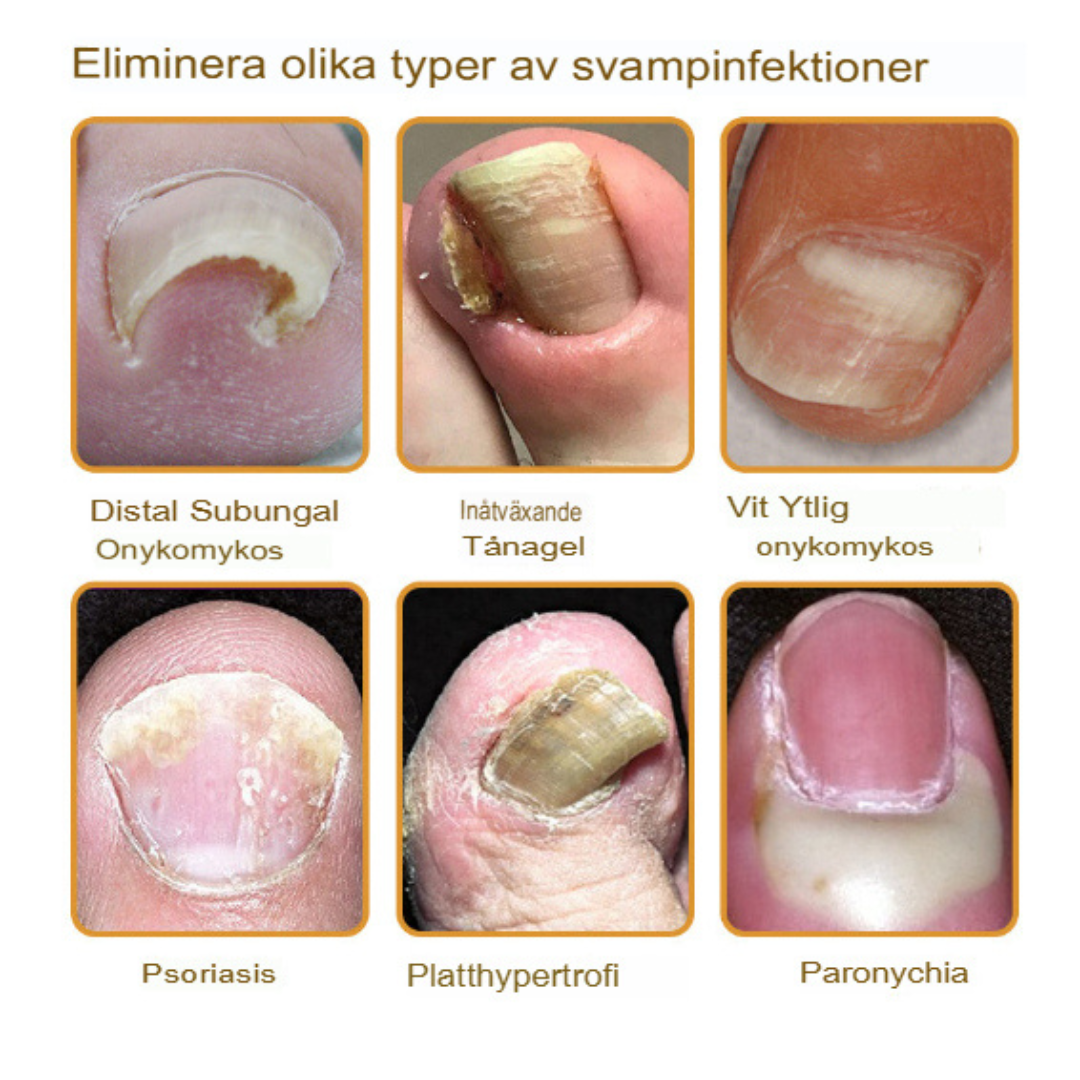 NailRepair™ | Fast-Acting, Long-Lasting Relief