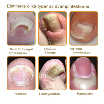 NailRepair™ | Fast-Acting, Long-Lasting Relief