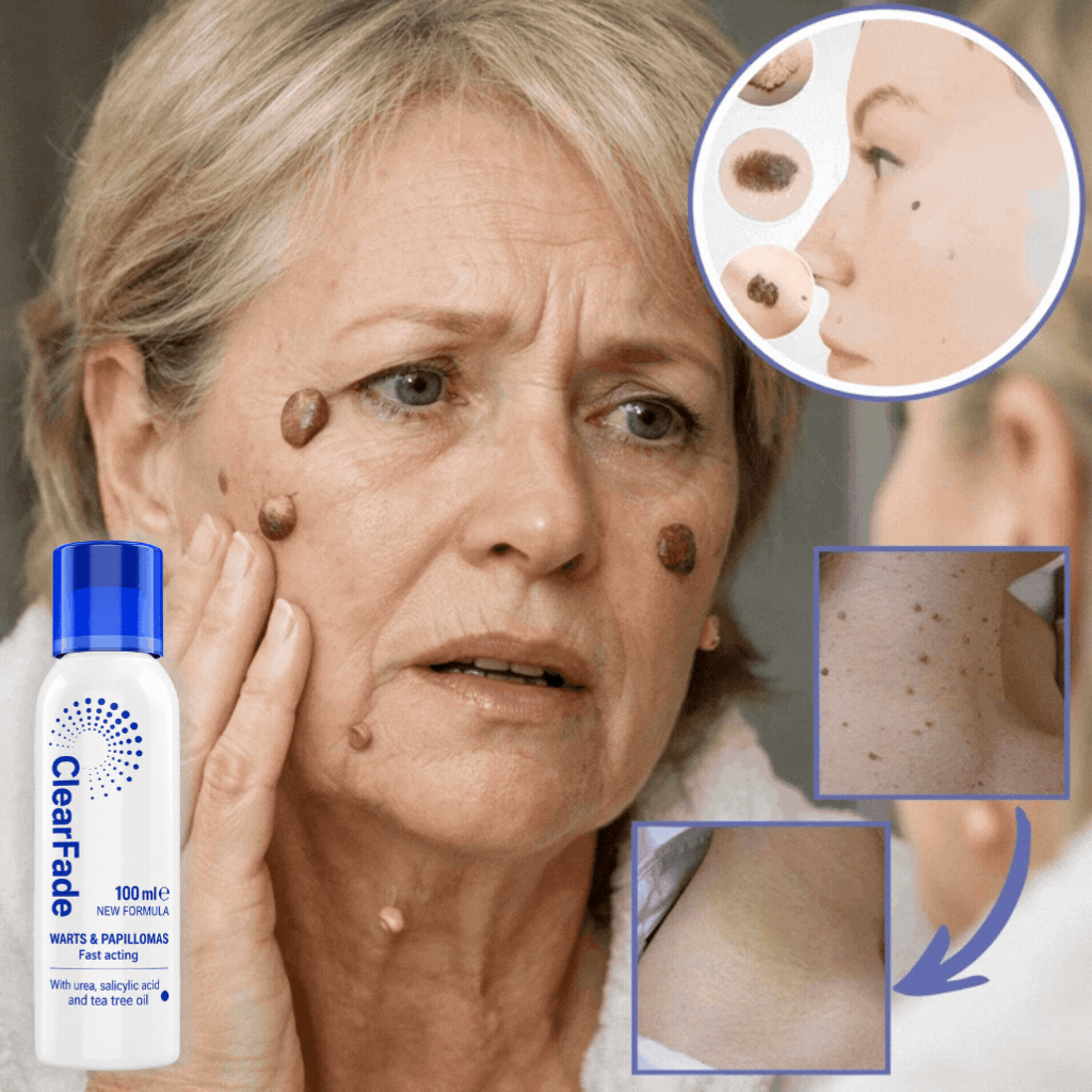 ClearFade™ Wart Serum | Visibly fade stubborn spots in just 7 days