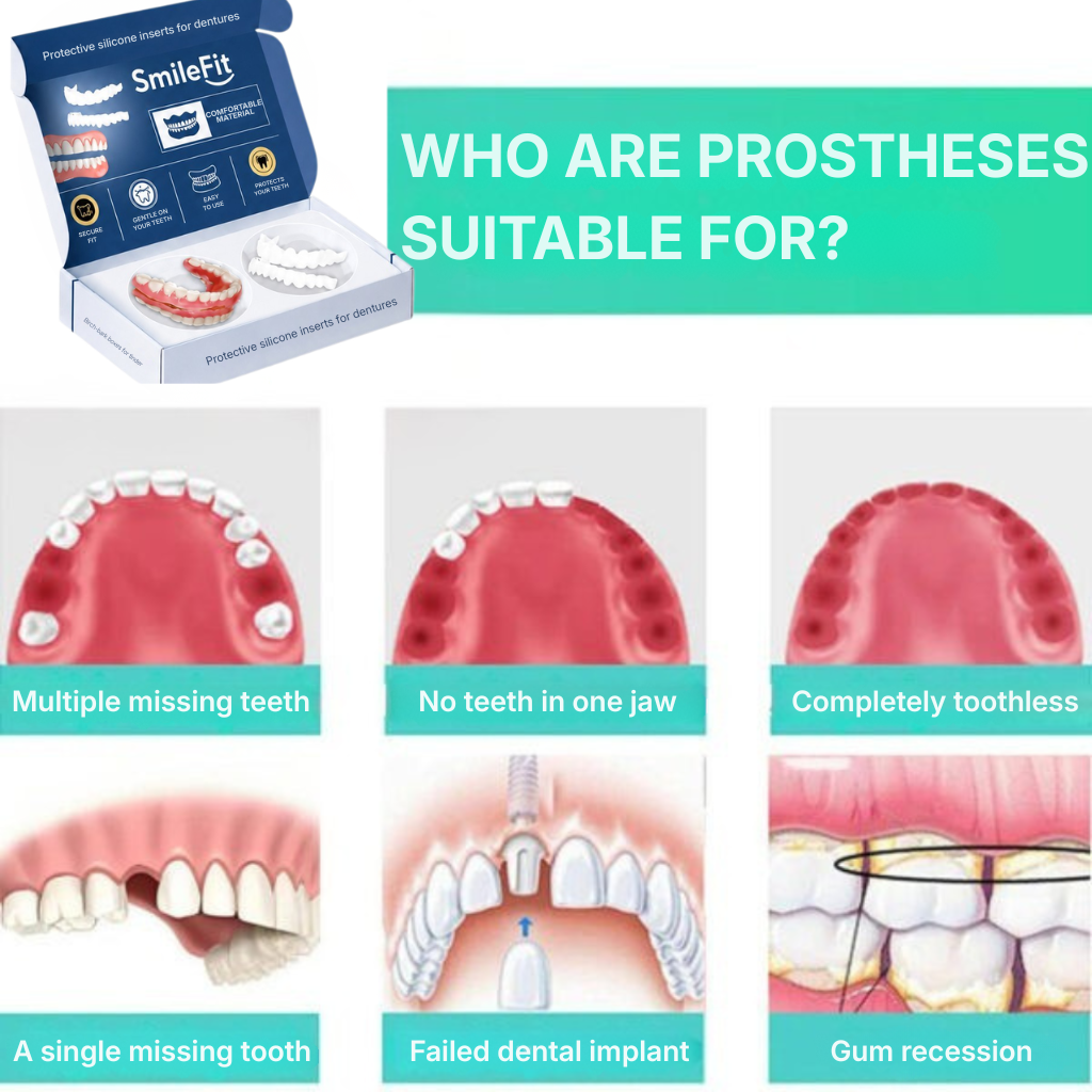 SmileFit™ | The perfect, instant smile—pain-free and without an appointment.