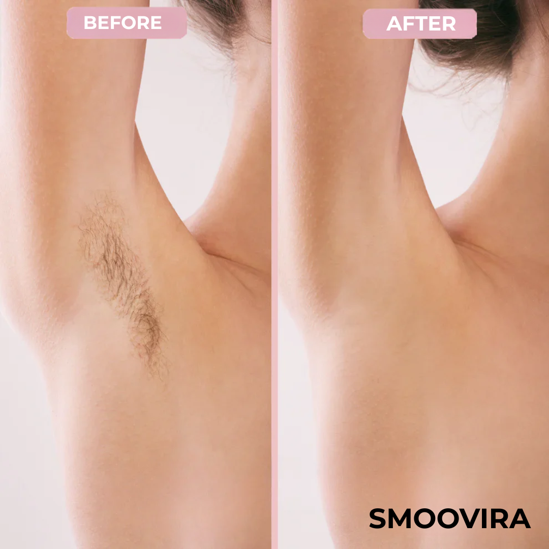 Smoovira™ 2-in-1 Body Shaver