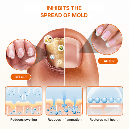 MycoMira™ Fungal Nail Treatment
